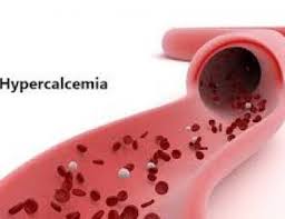 Image result for Hypercalcemia