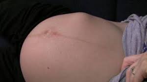 Gerakan bayi dalam kandungan semakin kuat. 13 Gerakan Janin Dalam Kandungan Ini Bikin Haru Sekaligus Merindi