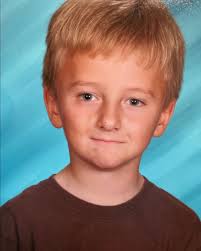 Conoce la historia de Lukas y su lucha con el síndrome de Parry-Romberg