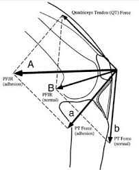Fat Pad Syndrome Physiopedia