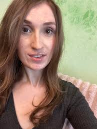 Hello, my name is Ivan, I am 31 years old and I am from Ukraine, the city  of Mariupol. As a result of the fighting, I lost everything, my wife and son