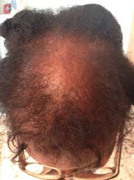 Epingle Sur Presentation De L Antichute Des Cheveux Shiva Gautier