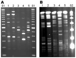 Sık sık gündeme gelen pcr testinin ne demek olduğu internette en fazla. Polymerase Chain Reaction Genetic Testing For Covid 19 Coronavirus