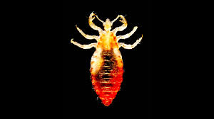 Image result for Typhus