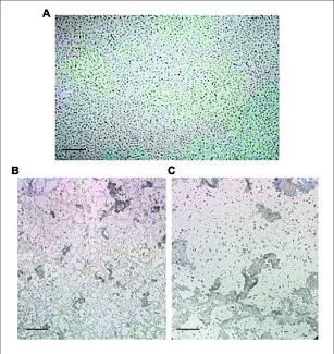 BRV Monolayer Cytopathic Effect (CPE), AI generated