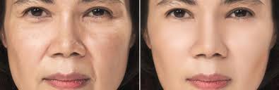 Best Medical Spa Services in San Mateo