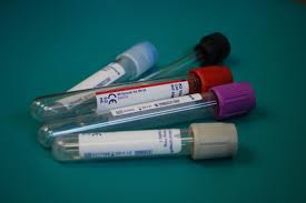 Infection with some viruses, including feline immunodeficiency virus or feline leukaemia virus (see f iv and felv) may increase the chances of getting cancer. Simple Blood Test For Early Detection Of Breast Cancer