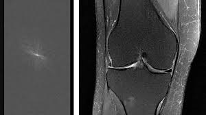 Fastmri Open Source Tools From Facebook And Nyu Facebook