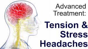 Tension Headache Treatment Youtube