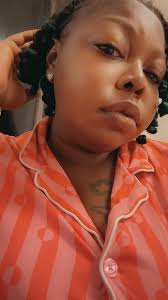 Living with classic pku and poland syndrome