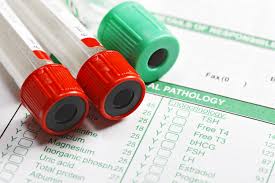 Image result for Test Specificity