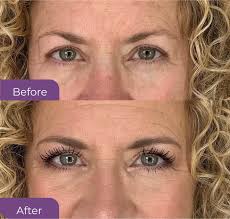 Best Mascara For Length & Volume For Aging Lashes