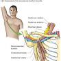 Thoracic outlet syndrome pain pattern from www.physio-pedia.com