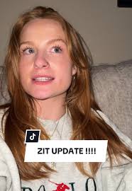 UPDATE ON MY FACE!!! #part2 #mrsa #zit #nurse #cellulitis #greenscreen...