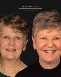 O V E R 6 5 It's not uncommon that women and men will share with me what  they wish they could change about their smile. But when asked if they'd like