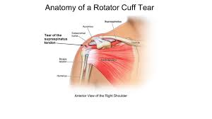 Shoulder anatomy is an elegant piece of machinery having the greatest range of motion of any joint in the body. Therapia Physiotherapy For Shoulder Pain