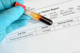 Psa Level 3 Months After Radiation Tx May Predict Outcome