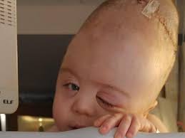 Fundraiser for Caitlyn Baird by Alexa Racine : Help Henry Get a Helmet