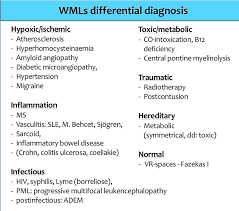 The Radiology Assistant Multiple Sclerosis Diagnosis And Differential Diagnosis