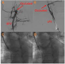 Diagnostics | Free Full-Text | A Review Of The Role Of Imaging Modalities  In The Evaluation Of Viral Myocarditis With A Special Focus On  Covid-19-Related Myocarditis