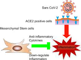 Maybe you would like to learn more about one of these? Stem Cells Therapy As A Possible Therapeutic Option In Treating Covid 19 Patients Springerlink