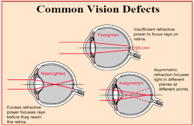 Nearsightedness Farsightedness And Astigmatism Human Eye 1 Astigmatism Human Eye The Retina