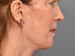 Meet Dr. Bassiri-Tehrani