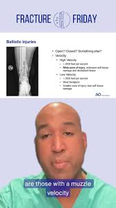 It’s #FractureFriday! In today’s video, Dr. Chad Ishmael covers ballistic  fractures and essential tips for your rotations. , ✅ Watch now to boost  your orthopedic knowledge and stay ahead during ...