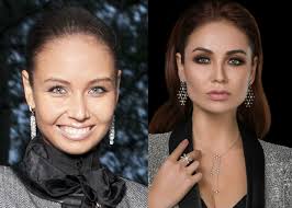 Хотя в молодости она и с таким носом хорошо смотрелась. Lyajsan Utyasheva Do I Posle Plastiki Lica Foto Umnica Krasavica