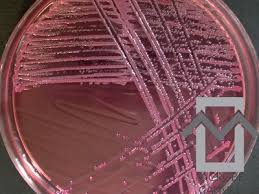 Image result for yersinia fotos