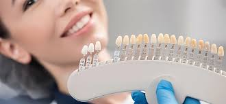 عوامل موثر بر طول عمر کامپوزیت چیست ونحوه مراقبت از ونیر کامپوزیت