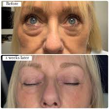 Let's welcome our new followers. If you'd like info about joining a  supportive community & attend our events click below 👇  www.thecheshireclub.com/membership www.thecheshireclub.com/mentor  www.thecheshireclub.com/events-for-your-diary Denise Beckett ...