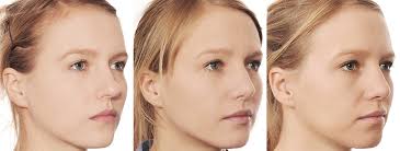 So soll die nase nach dem schminken möglichst aussehen. Wie Man Die Breite Nase Schlank Macht Wochentliche Sandwich Diat Menus