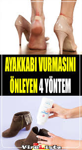 Ayakkabi Vurmasi Nasil Onlenir Ayakkabi Vurmasina Ne Iyi Gelir Ayakkabilar Saglik Kadin Elbiseleri