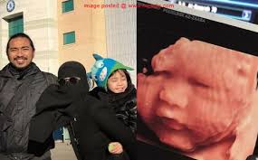 Beliau juga terkenal menerusi lagu arjuna beta. Fynn Jamal Sambut Anak Angkat Kedua Hujung Oktober Ini Menerusi Laman Instagram Baru Baru Ini Penyanyi Fynn Jamal Telah M Penyanyi Bayi Perempuan Kegembiraan