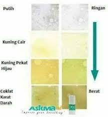 Yelah, mana taknya.bila si batuk dok serang tak henti henti, mulalah badan jadi mengah. Jom Kenali Warna Kahak Batuk Yang Berkahak Selalunya Bermula Di Bahagian Dada Warna Kahak Perlu Dikenalpasti Untuk Mengetahui Jenis Batuk Penyakit Yang Dialami 1 Kahak Yang Putih Atau Jernih Menunjukkan Tidak