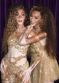 Image result for vitiligo model