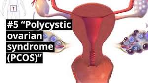 Pendarahan ini mestilah berpunca daripada rahim dan. Istihadah Abnormal Uterine Bleeding Darah Istihadah Doctoroncall