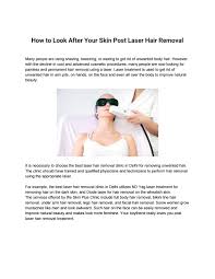 Before your appointment • it is imperative that you avoid sun exposure and tanning beds for at least 4 weeks prior to your treatment. How To Look After Your Skin Post Laser Hair Removal By Vedika Sharma1109 Issuu