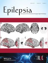 Current standards of neuropsychological assessment in epilepsy surgery  centers across Europe