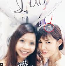 Hair Loss Treatment with HairMax+ Malaysia