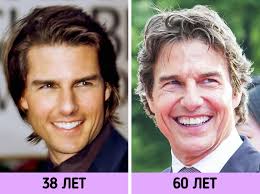 15 знаменитостей, лица которых круто преобразились с начала XXI века