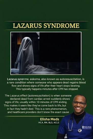 Understanding Lazarus Syndrome, a rare phenomenon of spontaneous  circulation return after CPR