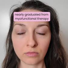 TOP 10 BEST Myofunctional Therapy in Escondido, CA