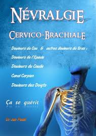 7 rue bergère 75009 paris. Nevralgie Cervico Brachiale Www Brachy Myotherapie Com