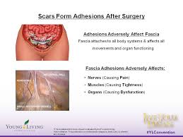 The Basic Anatomy Of A C Section Scar