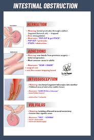 Image result for Adult Intussusception