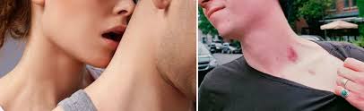 See more of syed saddiq syed abdul rahman on facebook. M Sian Girls Lost It After Finding Out Syed Saddiq Has Hickey On Neck In Vday Photo