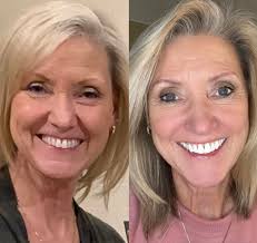 What is LimeLife by Alcone? LimeLife is a professional-grade beauty brand  that was created to bring the same high-quality makeup and skincare used by  professional makeup artists straight to everyday women (