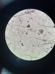 Image result for Demodex brevis